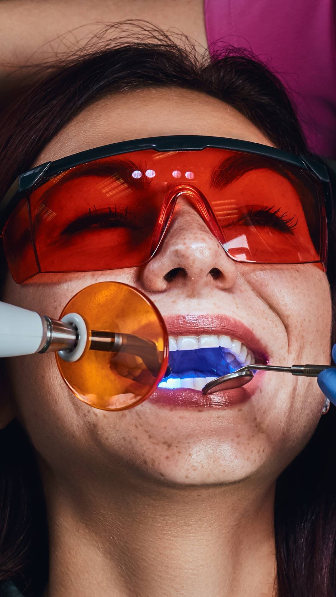 Clarear os Dentes SBC