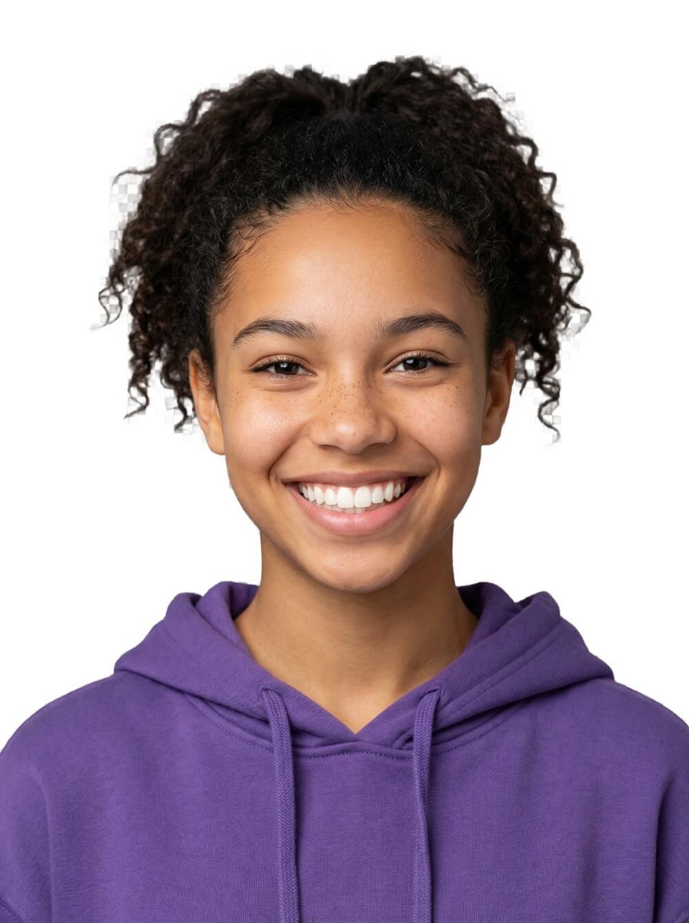 Paciente Clareamento Dental São Bernardo do Campo