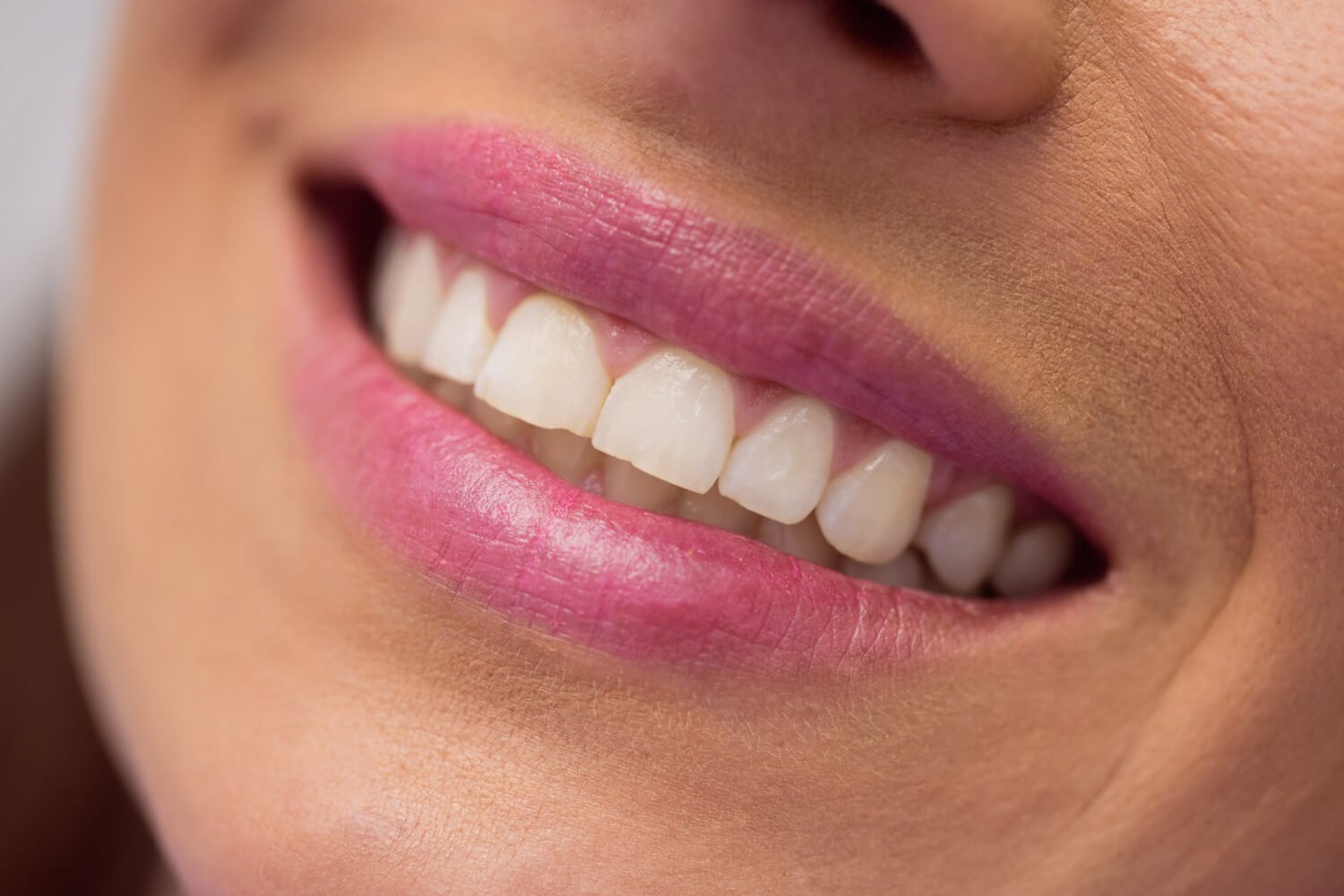 Sorriso feminino alinhado com dentes brancos após tratamento de facetas de porcelana na Clínica Pleno Ser em São Bernardo do Campo.