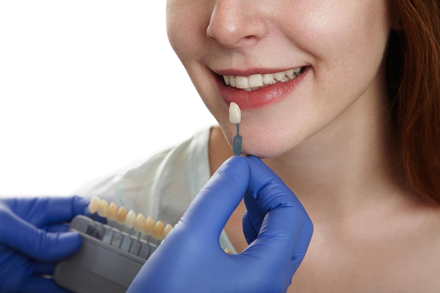 Paciente sorrindo enquanto dentista com luvas azuis compara a cor dos dentes com a escala para facetas de resina em São Bernardo do Campo.